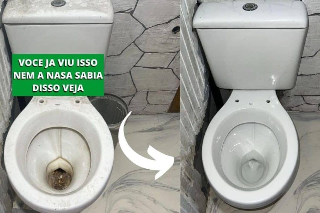 Como Tirar Amarelado De Vaso Sanitário