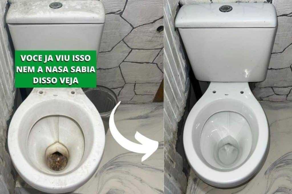 Como Limpar Vaso Sanitário Encardido