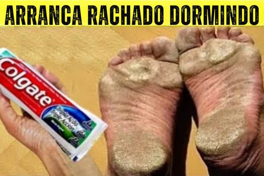 Dica Para Pés Rachados