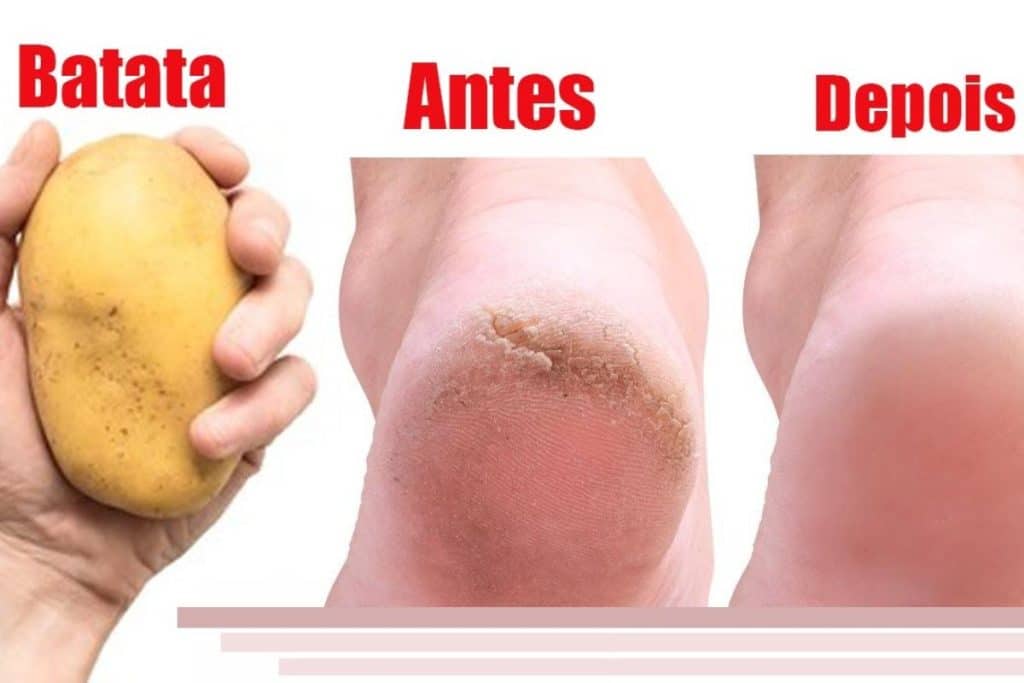 Como Deixar Os Pés Lisos