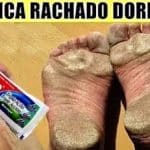 Como Tirar Rachadura Do Pés