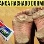 Como Tirar Rachaduras Dos Pés