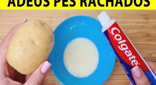 Essa é a melhor dica para pés rachados que você vai encontrar essa semana 2 dica para pés rachados
