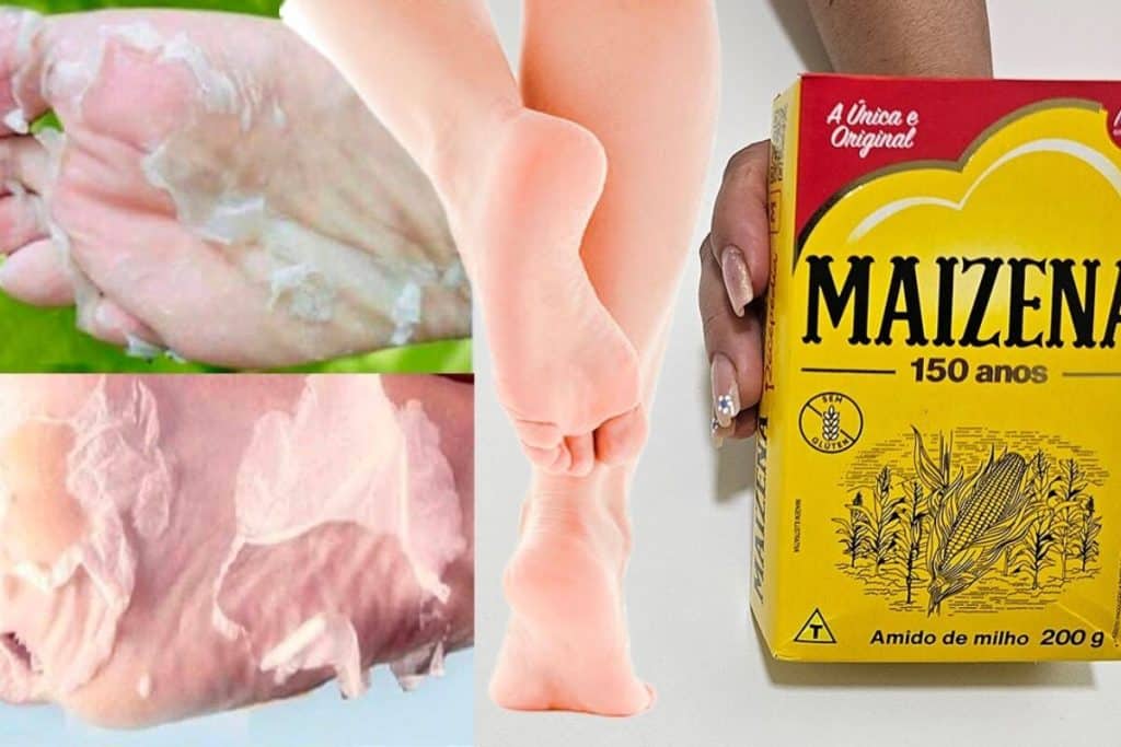 como tirar rachadura dos pés