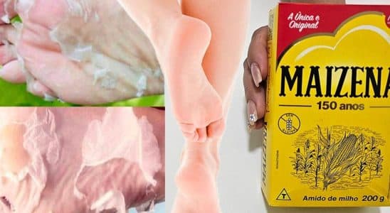 como tirar rachadura dos pés