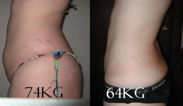 10 kgs