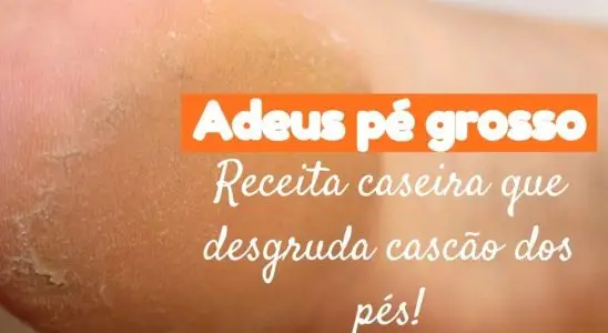 Dica para pés rachados que não falha e deixa seus pés lisinhos novamente 1 dica para pés rachados